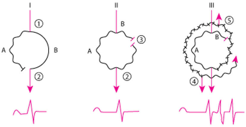Cơ chế vòng vào lại điển hình