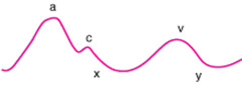 Нормальные пульсовые волны яремных вен