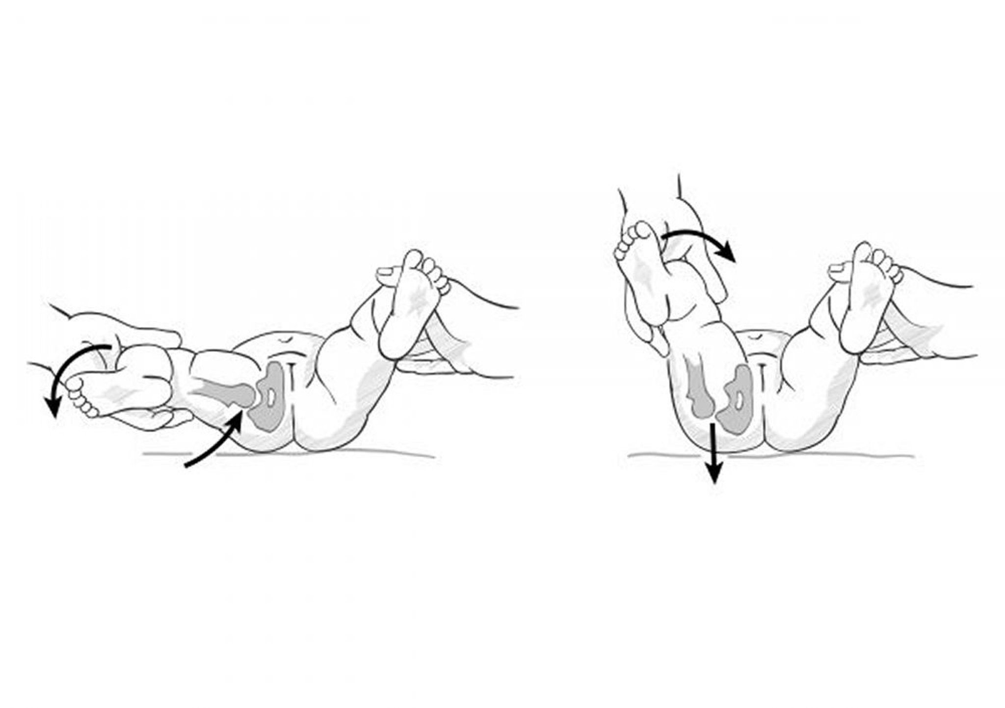 Tests for Developmental Dysplasia of the Hip