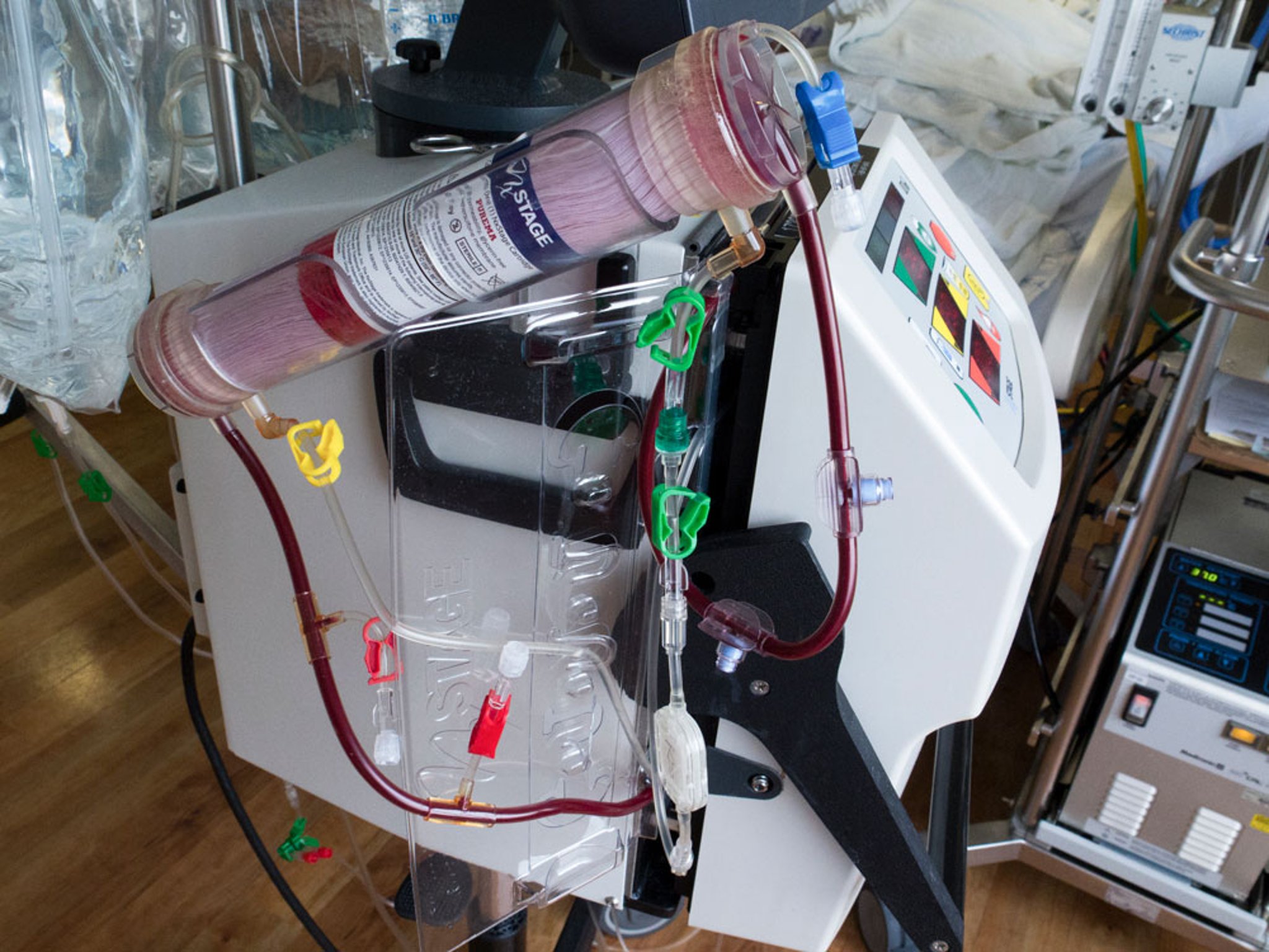 Continuous Kidney Replacement Therapy