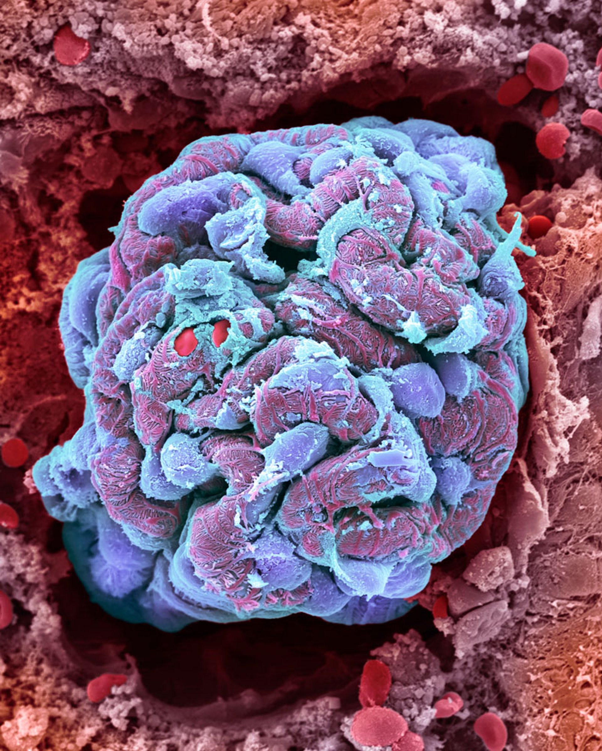 Glomérulo Renal (microfotografía electrónica de barrido)
