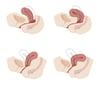 Varianti anatomiche dell'utero