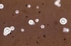 墨汁染色（Cryptococcus neoformans）