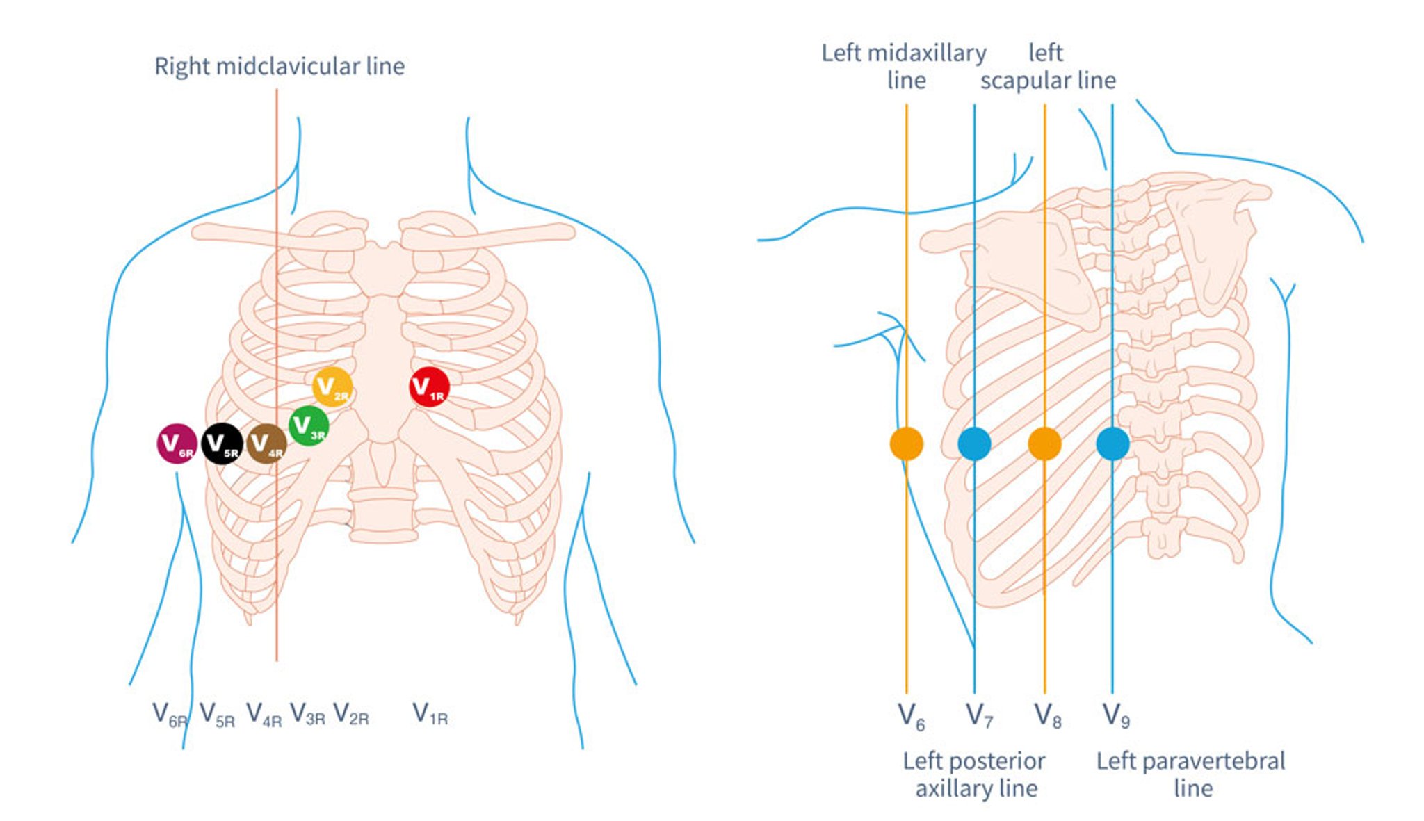 Right-Sided (V1R–V6R) and Posterior (V7–V9) Leads