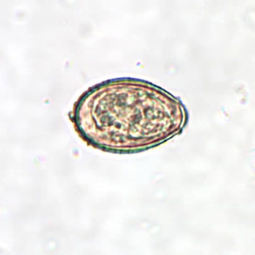 <i >Clonorchis sinensis</i>（华支睾吸虫）卵