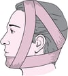 Bandage de Barton
