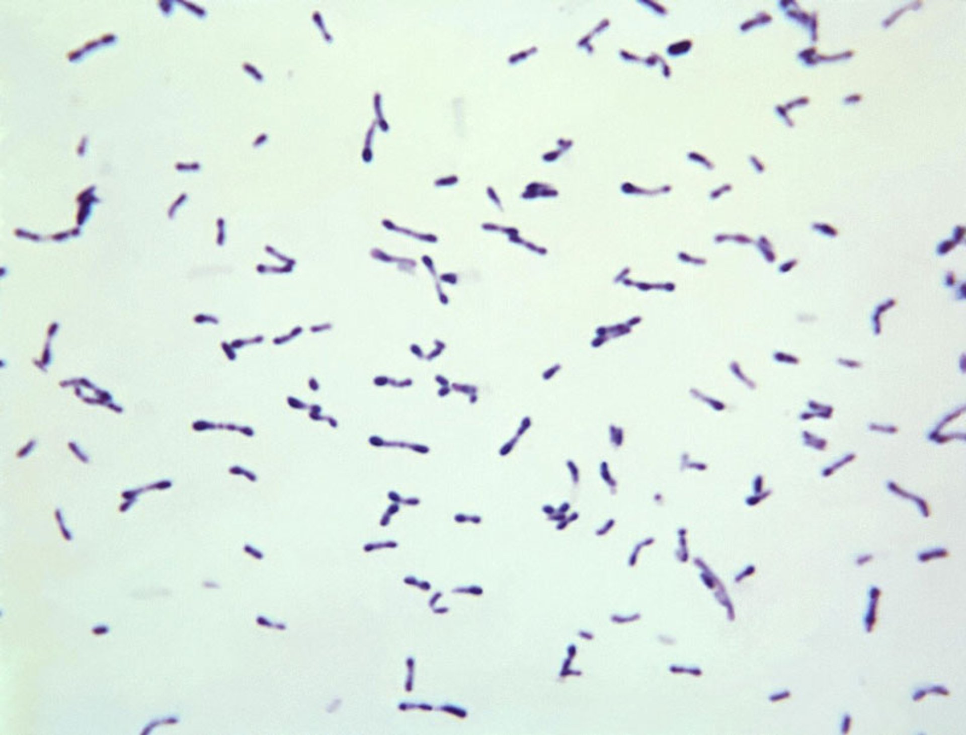 <i >Corynebacterium diphtheriae</i> (Tinción de Gram)