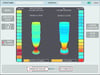 Impedance Planimetry