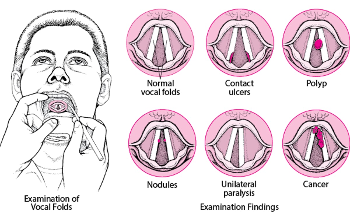 Laryngeal Disorders