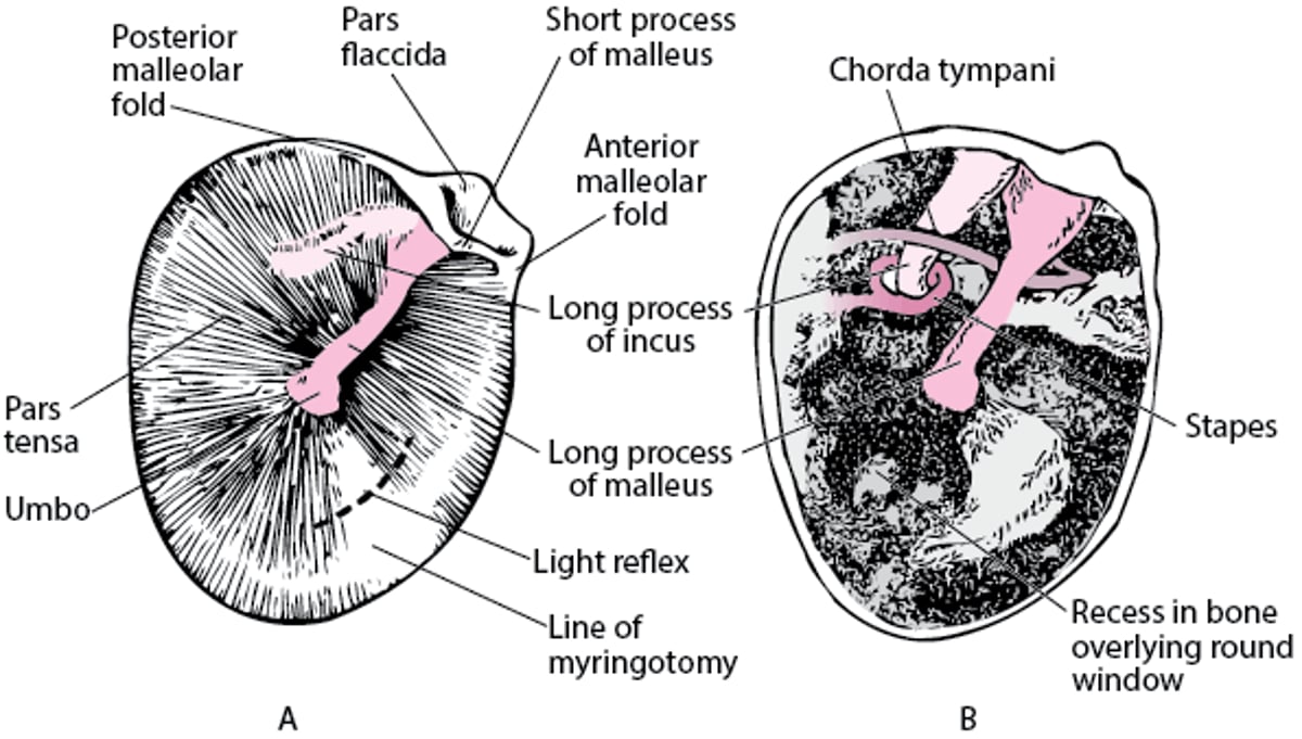 Tympanic Membrane of Right Ear (A); Tympanic Cavity with Tympanic Membrane Removed (B)