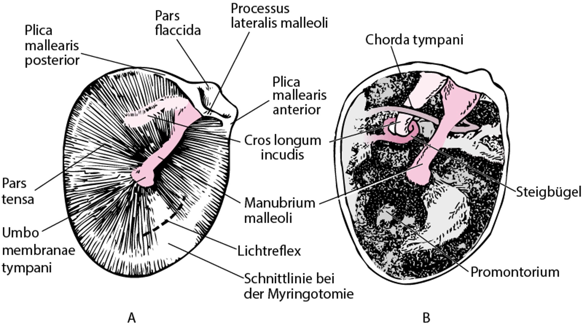 Trommelfell (Membrana tympanica) im rechten Ohr (A); Paukenhöhle (Cavitas tympani) nach Entfernung des Trommelfells (B)