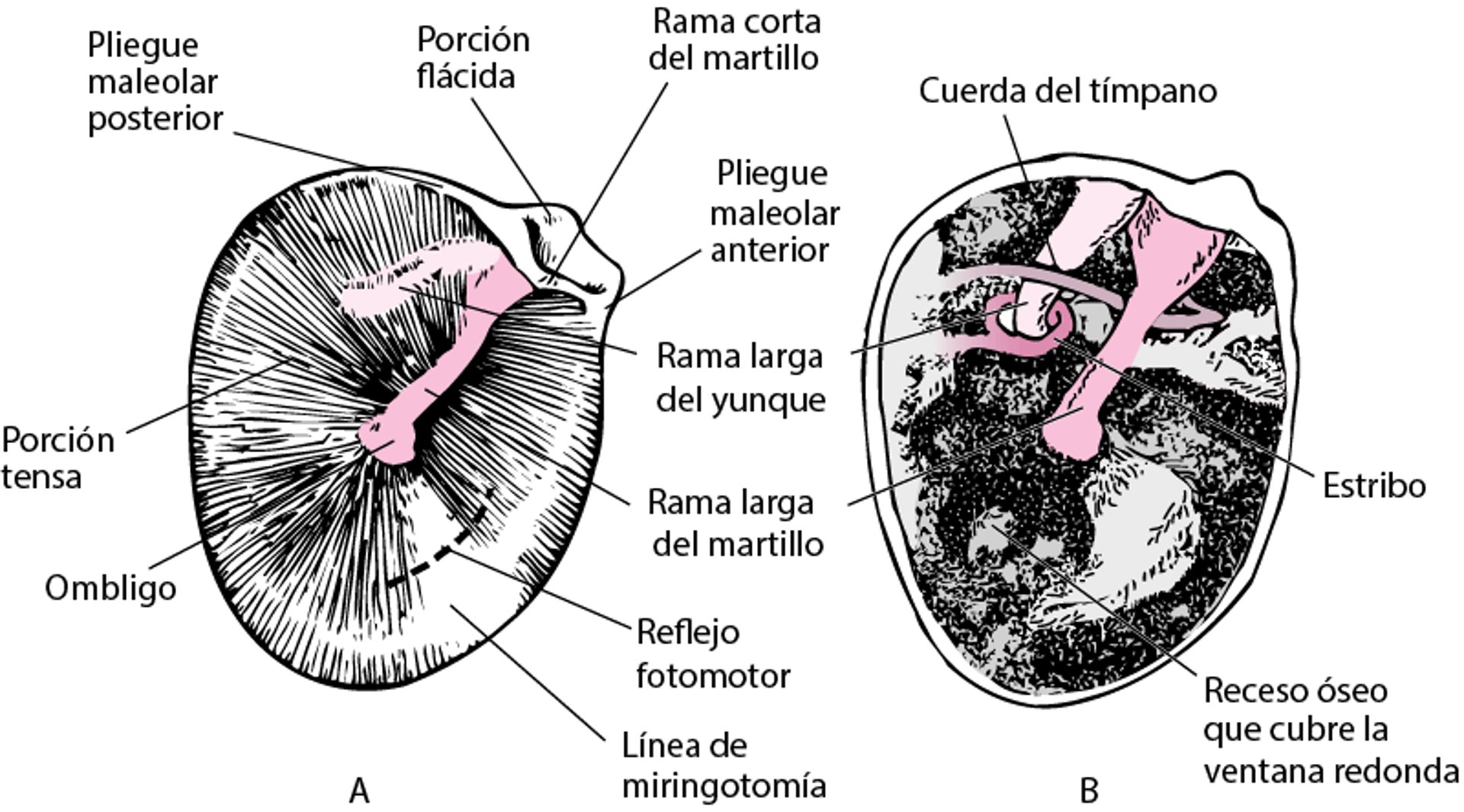 Membrana timpánica del oído derecho (A); cavidad timpánica con la membrana timpánica retirada (B)