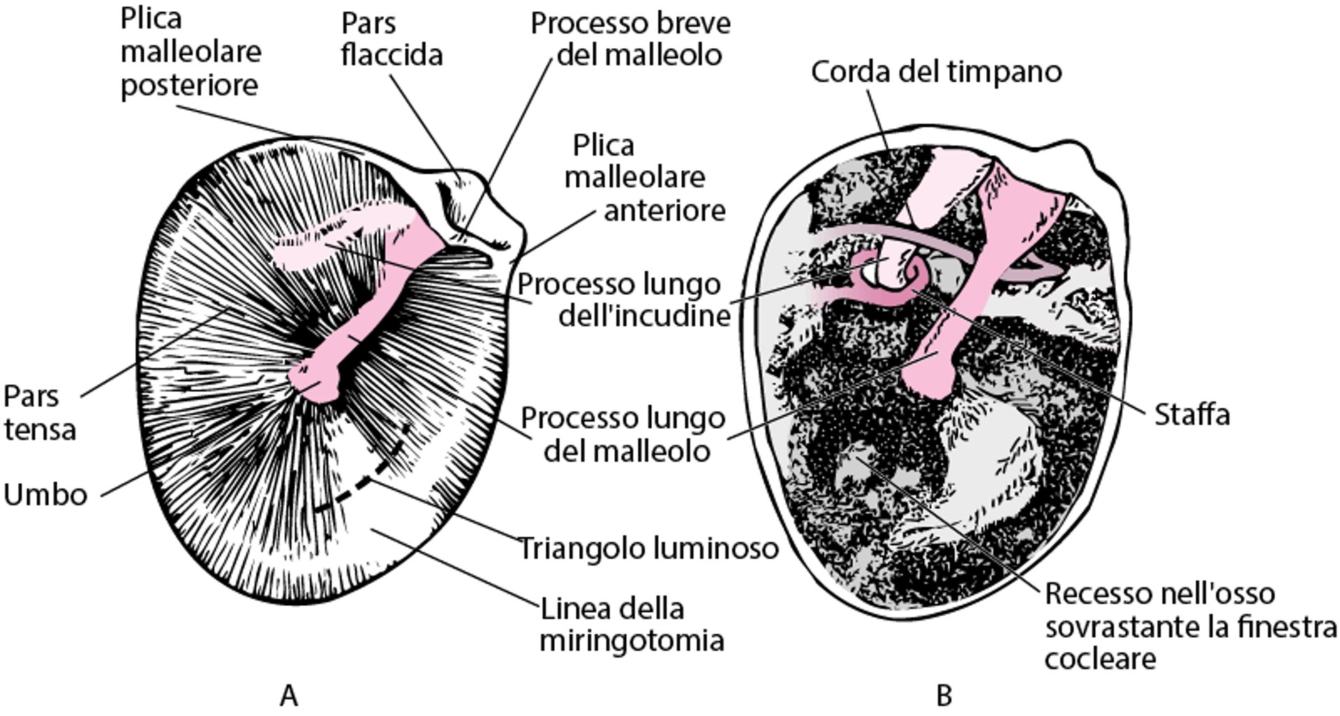 Membrana timpanica dell'orecchio destro (A); cassa timpanica dopo rimozione della membrana timpanica (B)