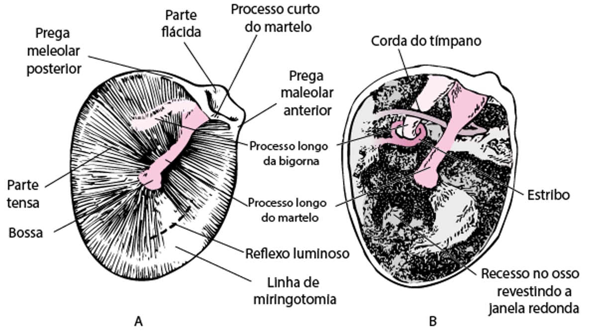 Membrana timpânica da orelha direita (A); cavidade timpânica com membrana timpânica removida (B)