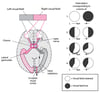 Higher Visual Pathways—Lesion Sites and Corresponding Visual Field Defects