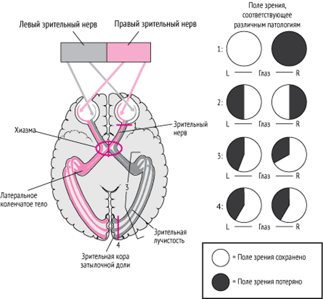 Выше расположенные зрительные пути - локализация поражения и соответствующие дефекты полей зрения