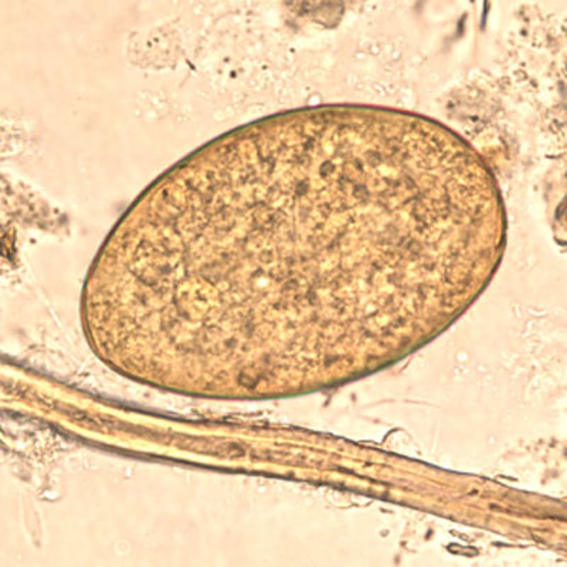 Huevo de <i >Fasciolopsis buski</i>