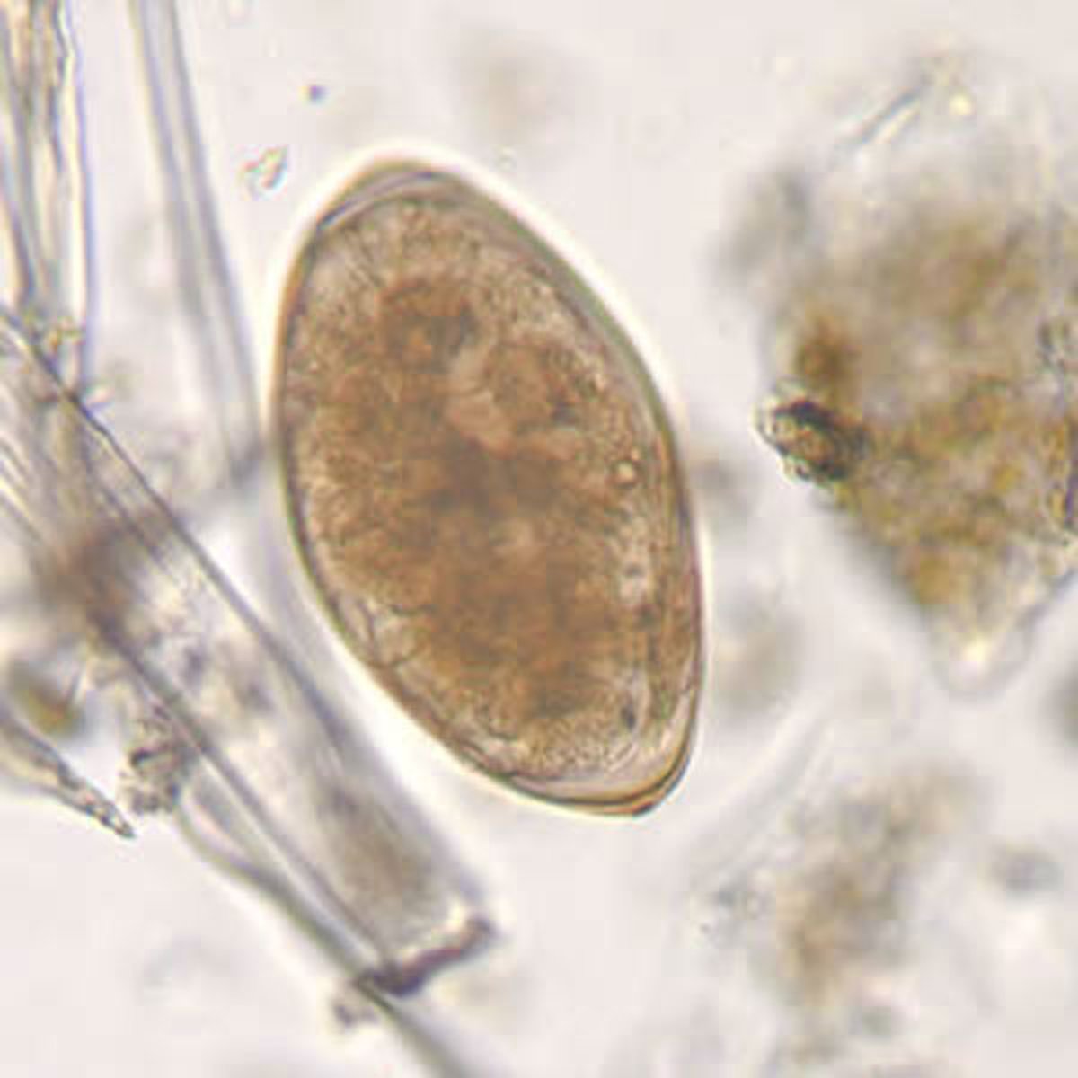 <i >Fasciola</i> Species Egg