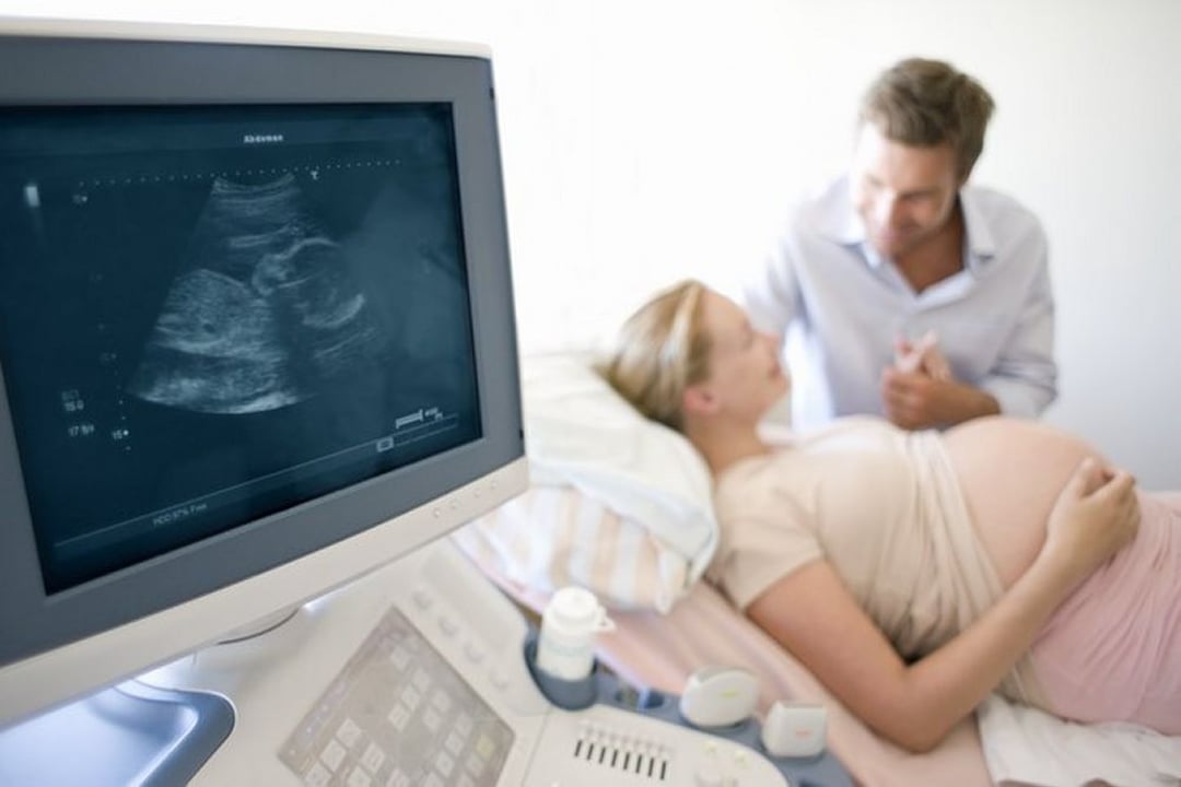 Sonographie - Sonographie - MSD Manual Profi-Ausgabe