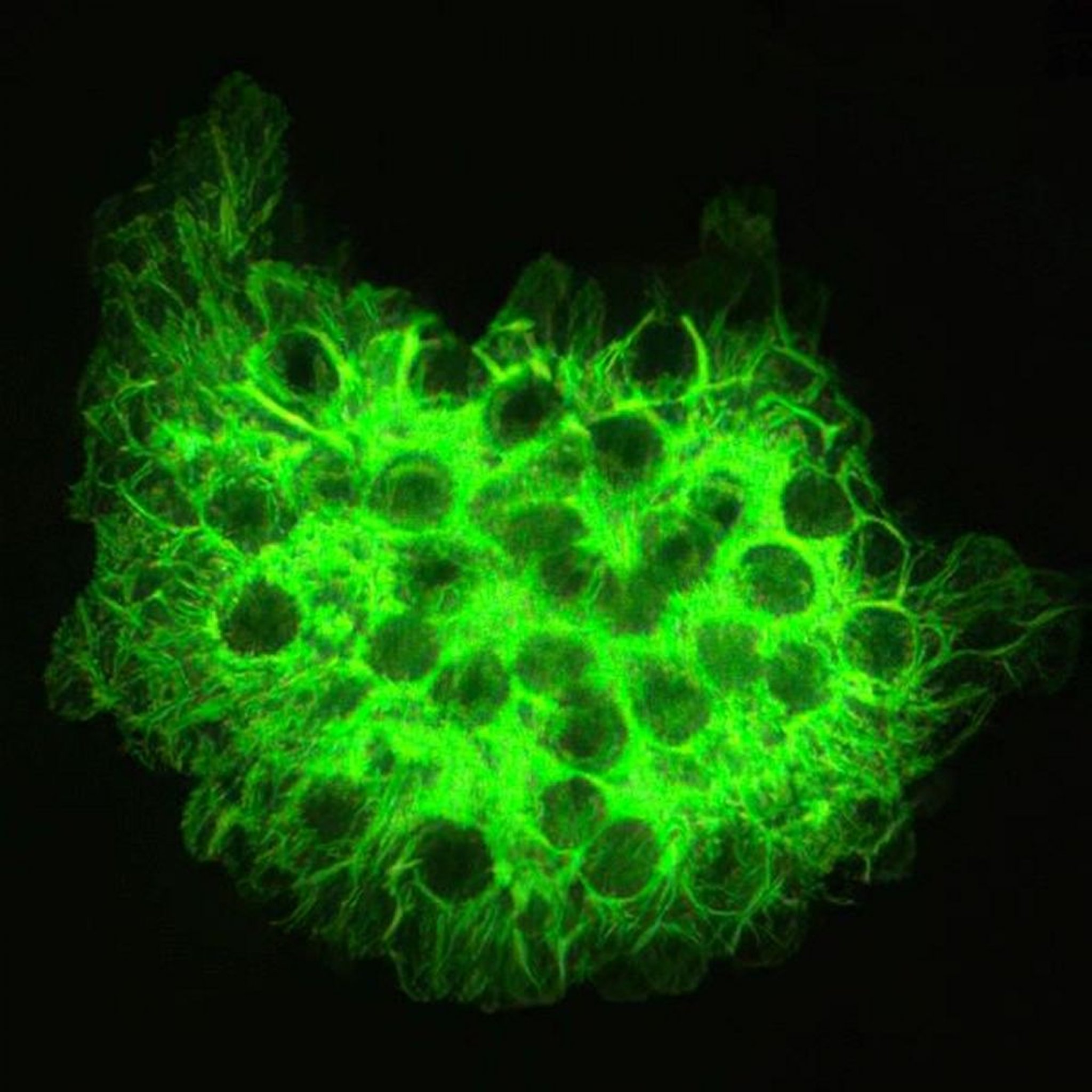 Coloration fluorescente (<i >Pneumocystis jirovecii</i>)