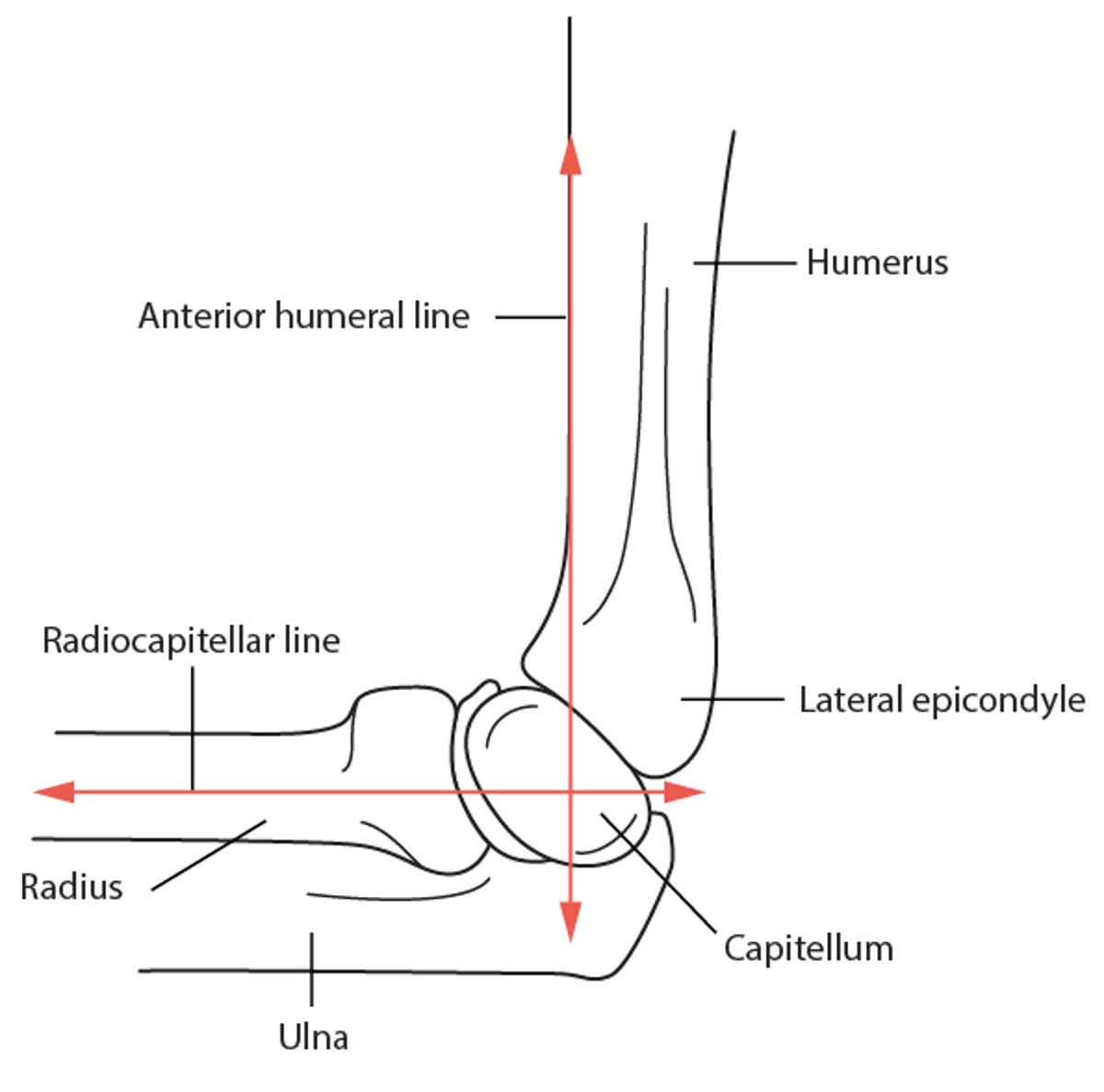 Anterior humeral line and radiocapitellar line