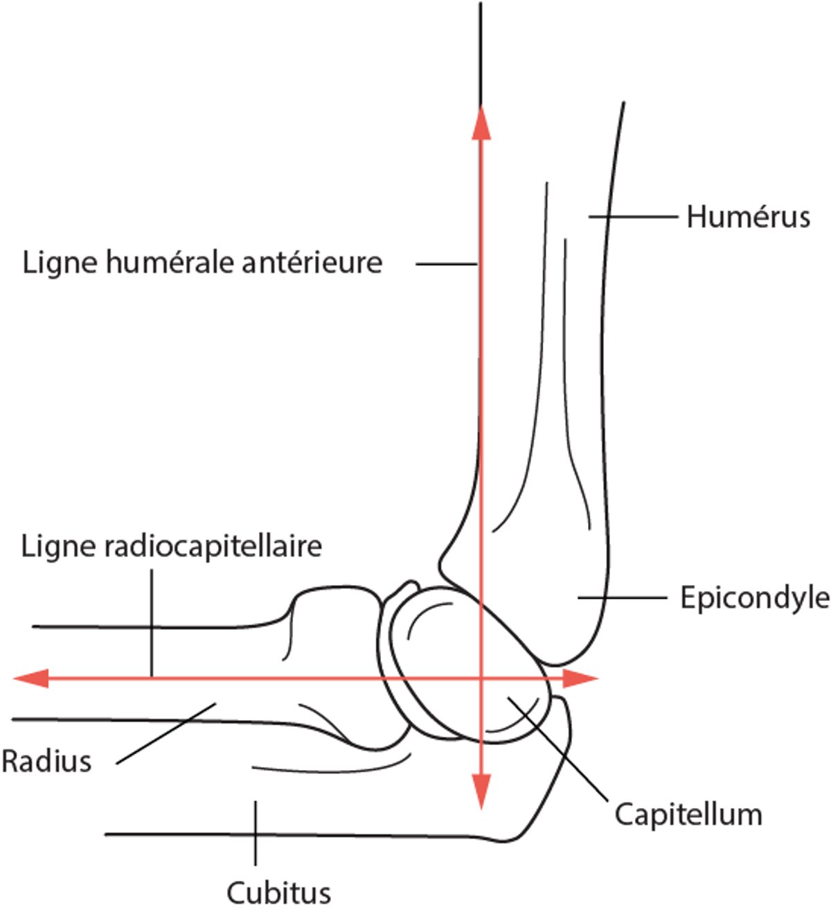 Ligne humérale antérieure et ligne radiocapitellaire