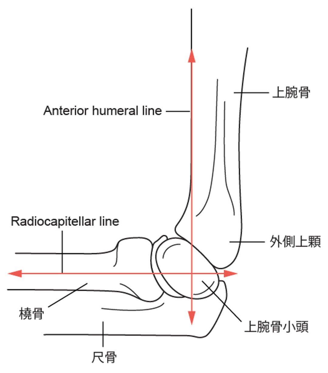 Anterior humeral lineおよびradiocapitellar line