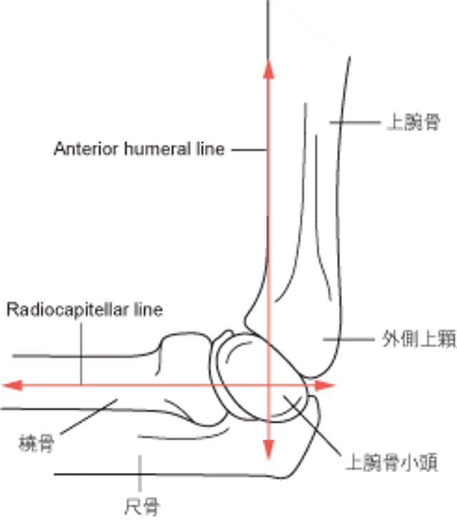 Anterior humeral lineおよびradiocapitellar line