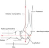 Linha umeral anterior e linha radiocapitelar