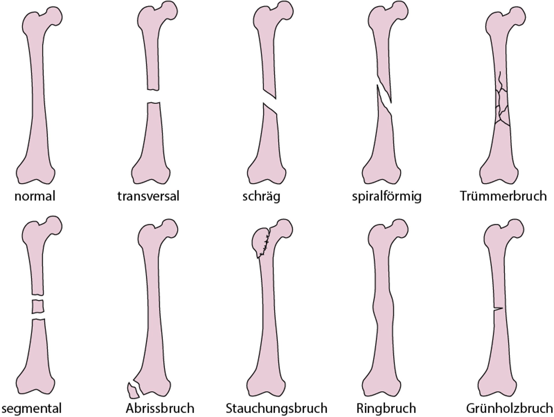 Gängige Typen von Bruchlinien