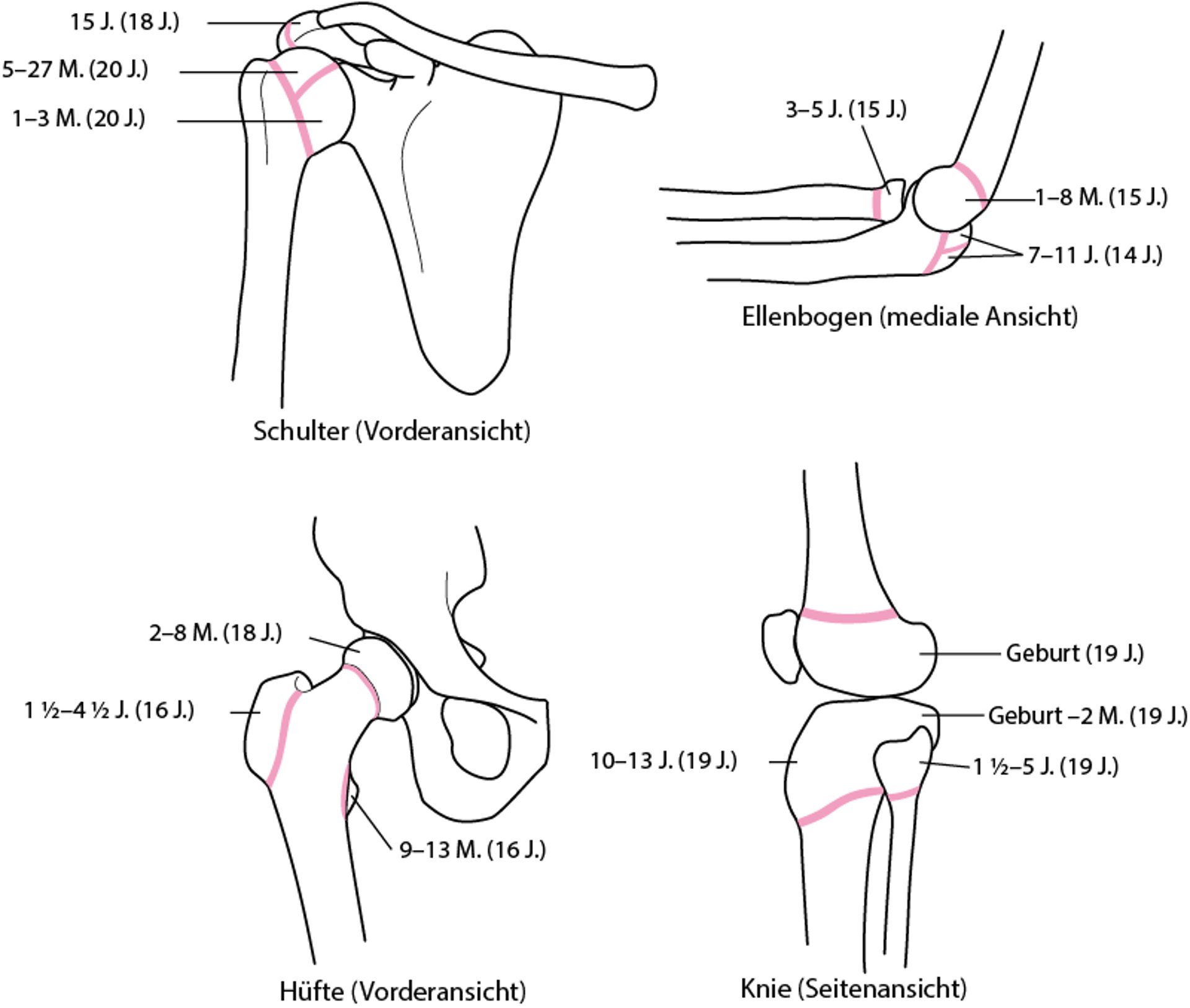 Epiphyseale Scheiben (Wachstumsfugen)