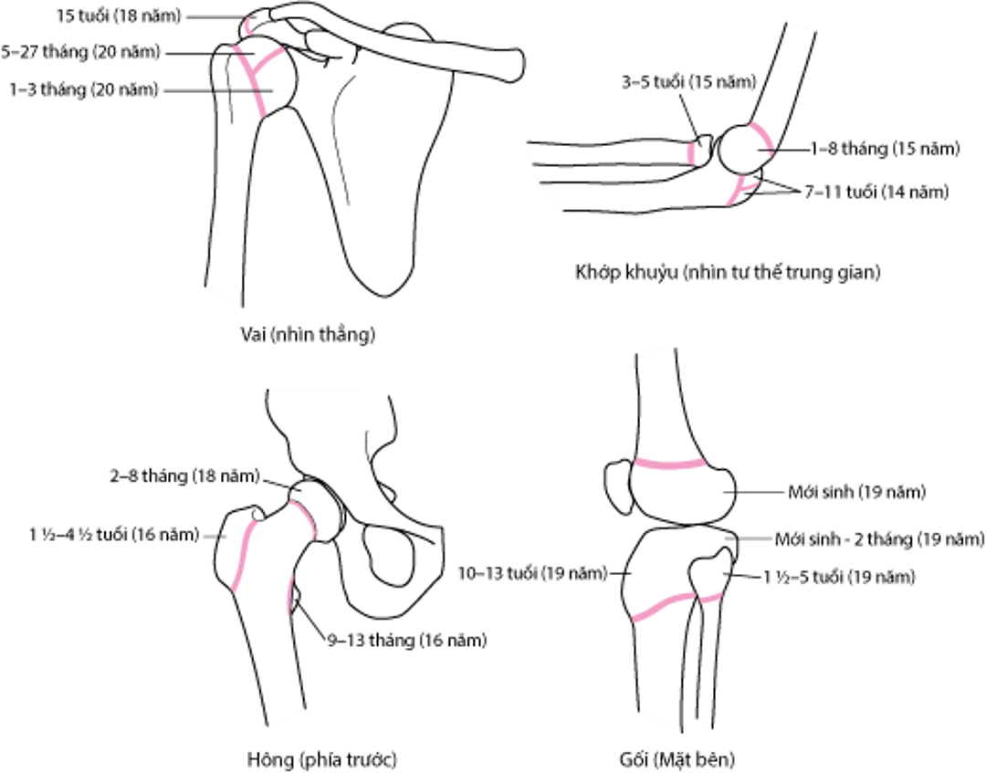 Tấm tăng trưởng (sụn tiếp hợp)