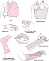 Joint Immobilization as Acute Treatment: Some Commonly Used Techniques