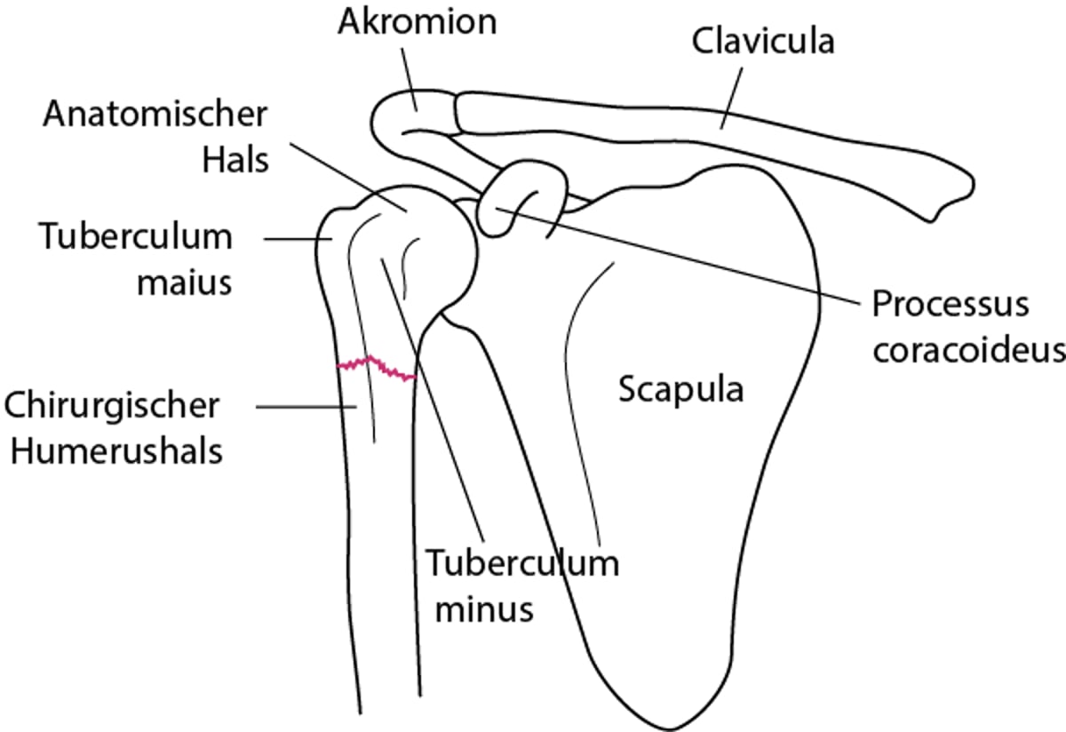 Wesentliche anatomischen Landmarken des proximalen Humerus