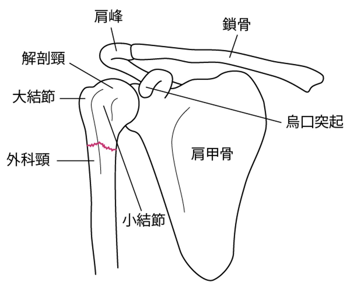 上腕骨近位部における重要な解剖学的ランドマーク