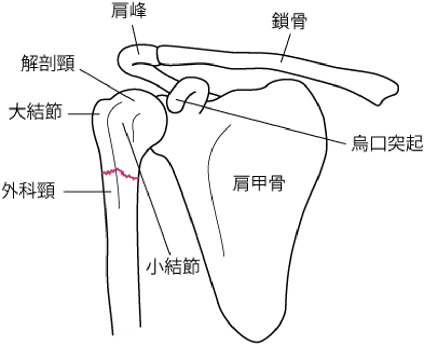 上腕骨近位部における重要な解剖学的ランドマーク