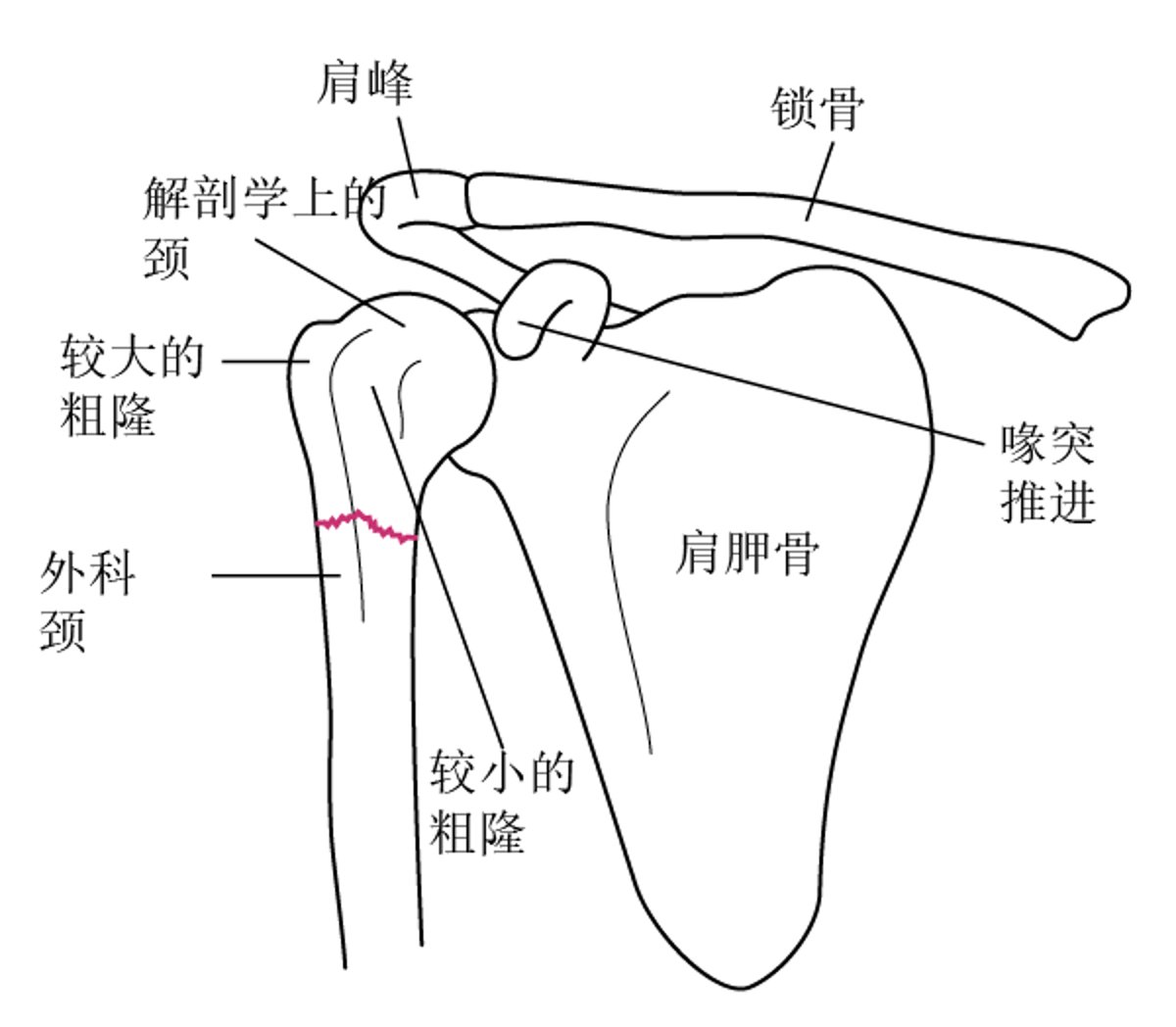 肱骨近端的重要解剖标志
