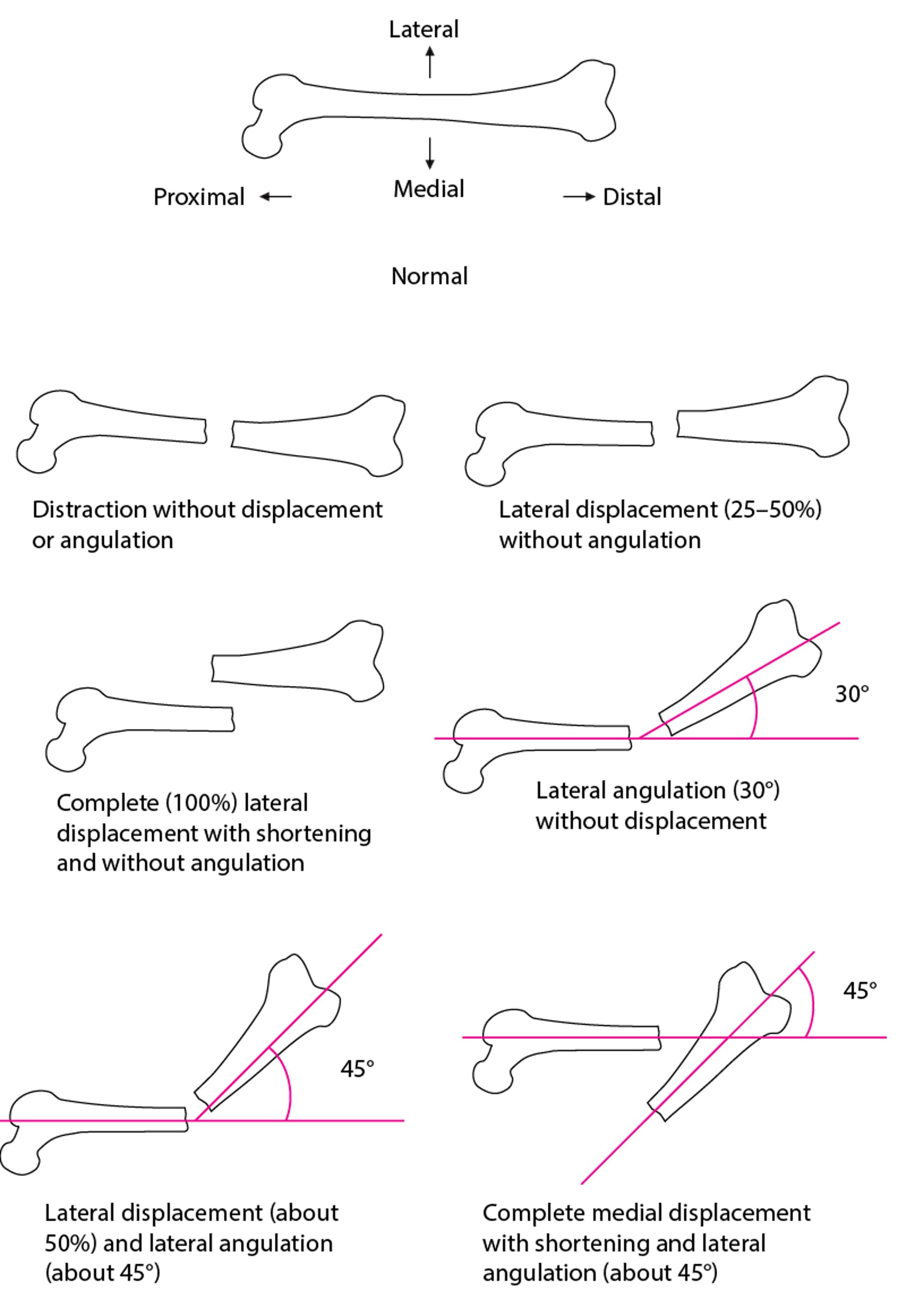 Spatial Relationship Between Fracture Fragments