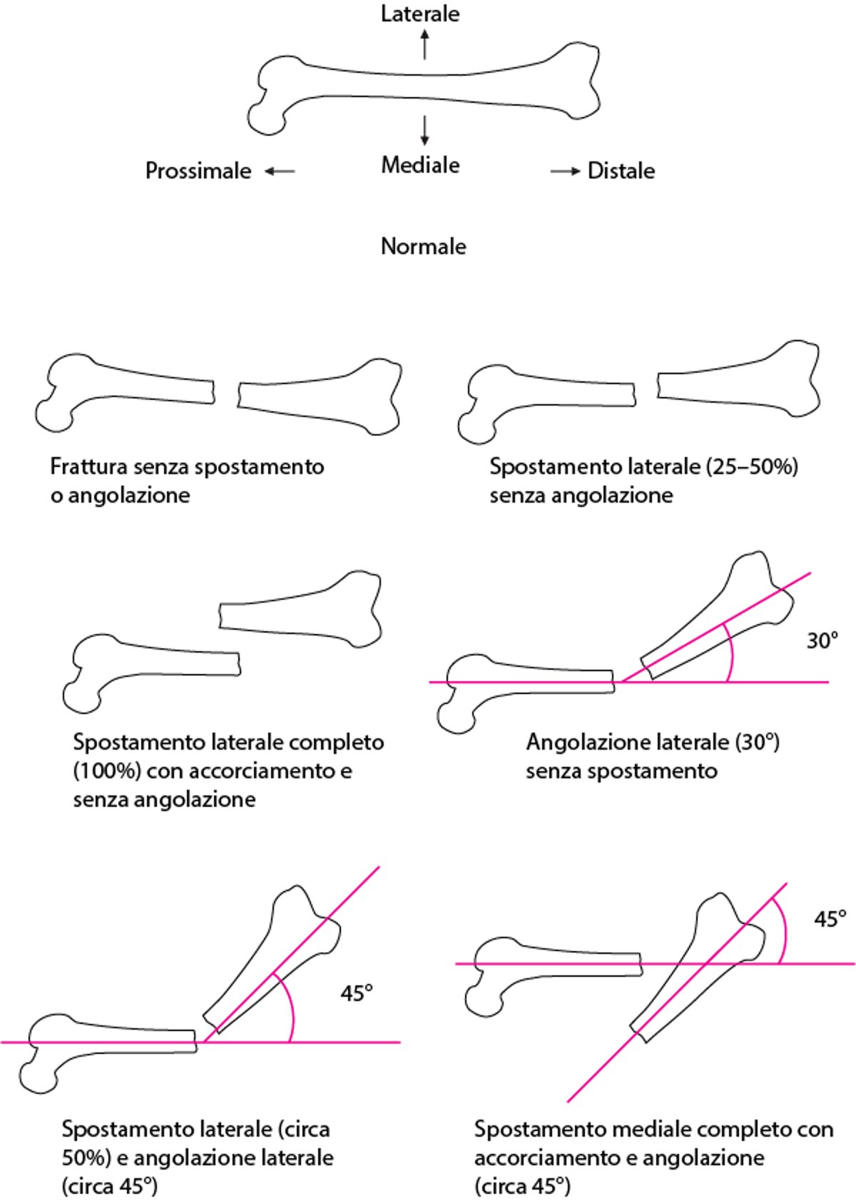 Relazione spaziale tra i frammenti della frattura