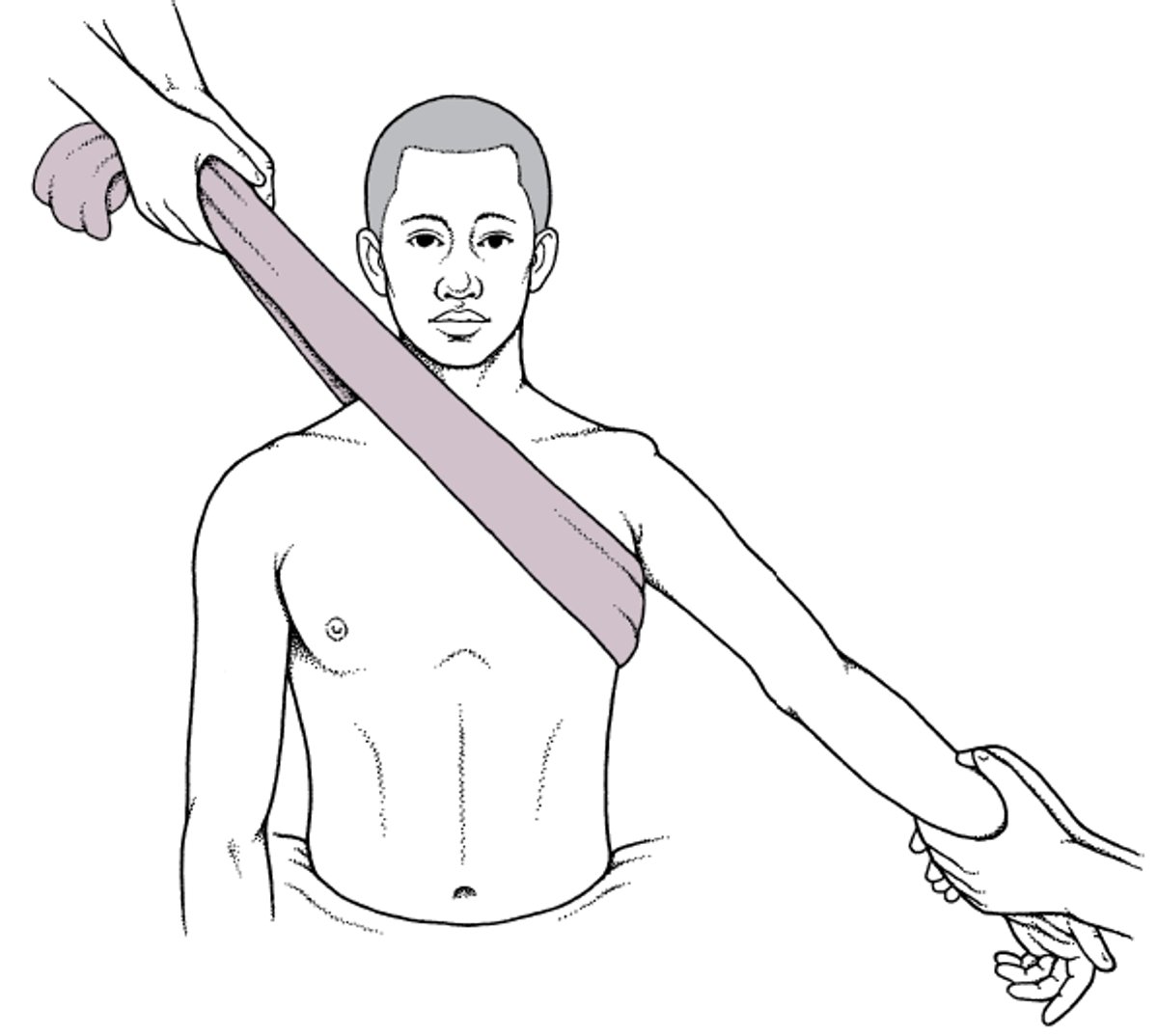 Traction-countertraction technique for reducing anterior shoulder dislocations
