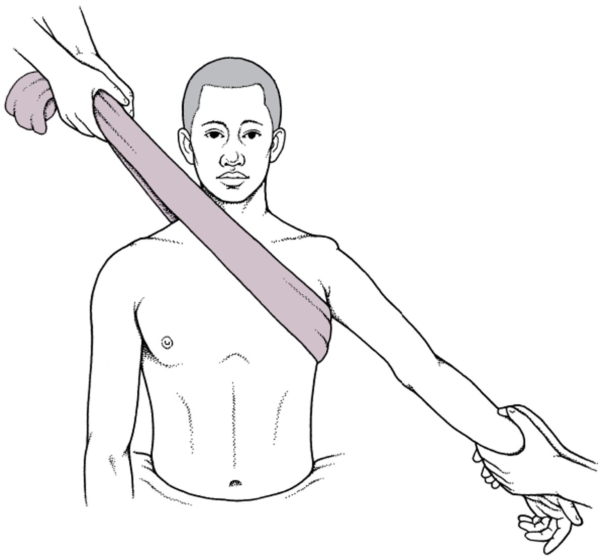 Technique de réduction par traction-contre-traction des luxations antérieures de l'épaule