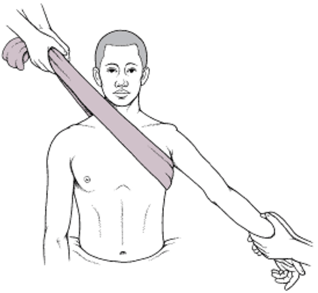 Техника вытяжения в противоположных направлениях для вправления вывиха плечевого сустава вперед