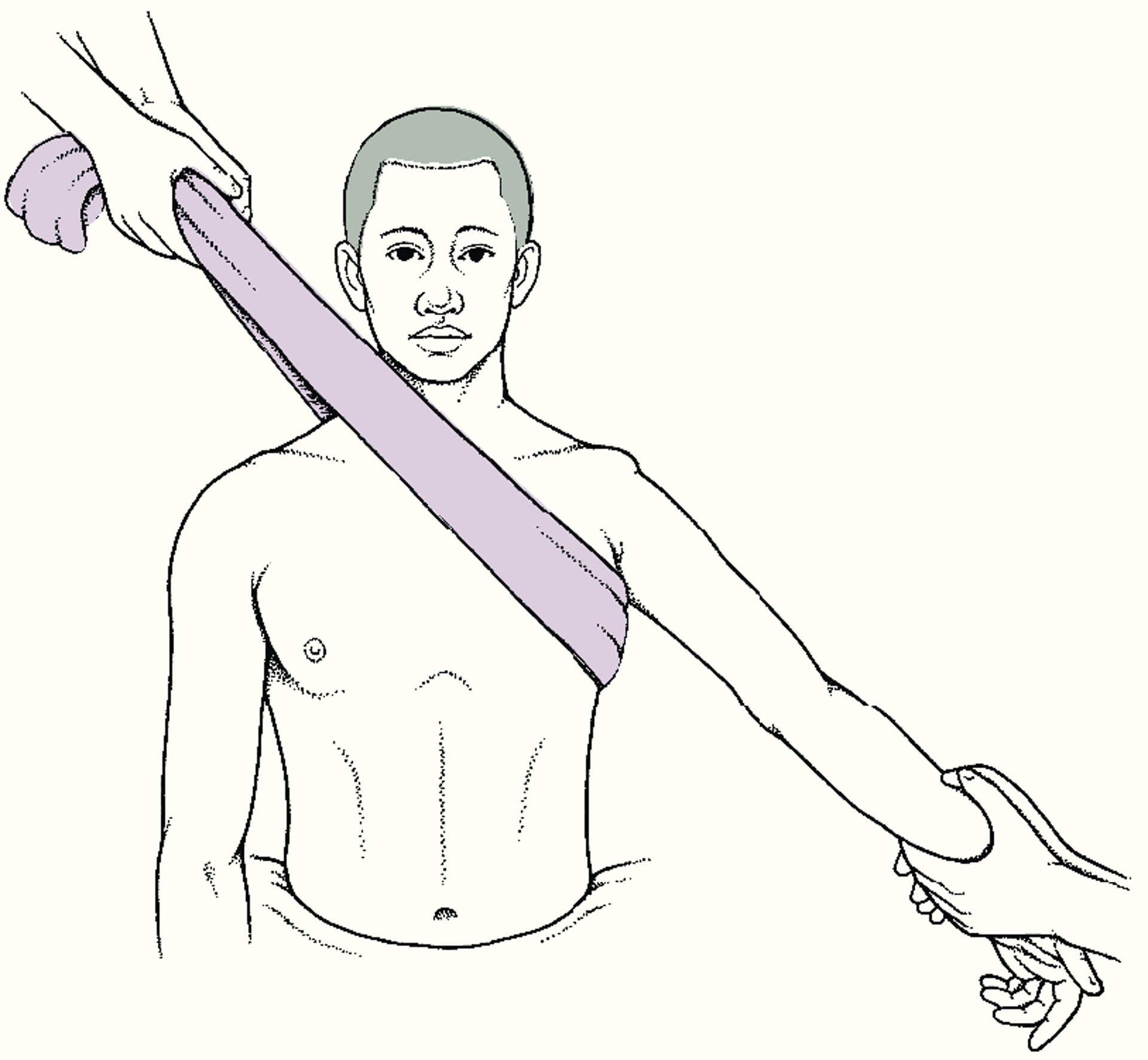 Kĩ thuật kéo-kéo ngược để nắn chỉnh trật khớp vai ra trước