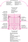 Location of Abdominal Pain and Possible Causes