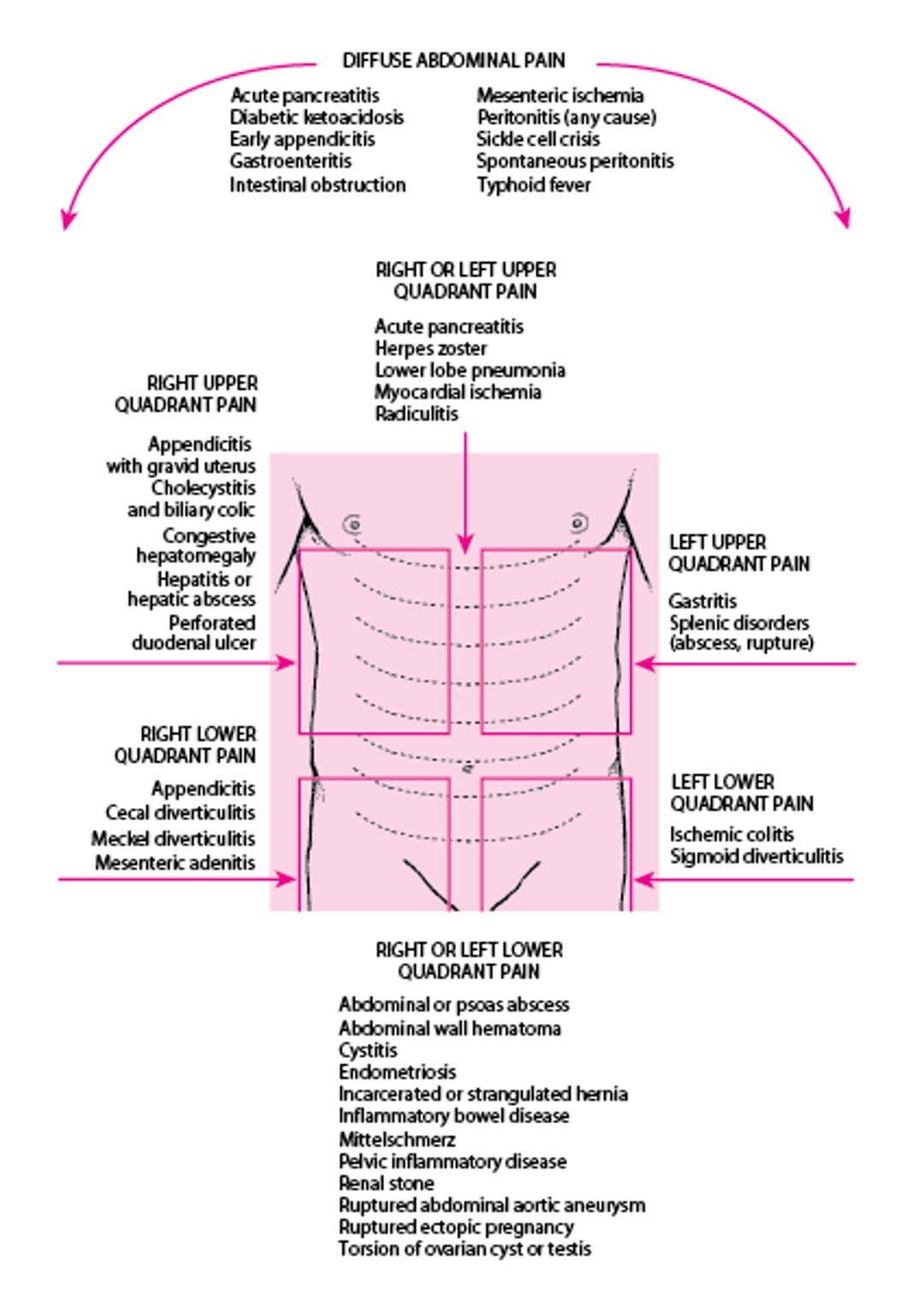 Location of Abdominal Pain and Possible Causes