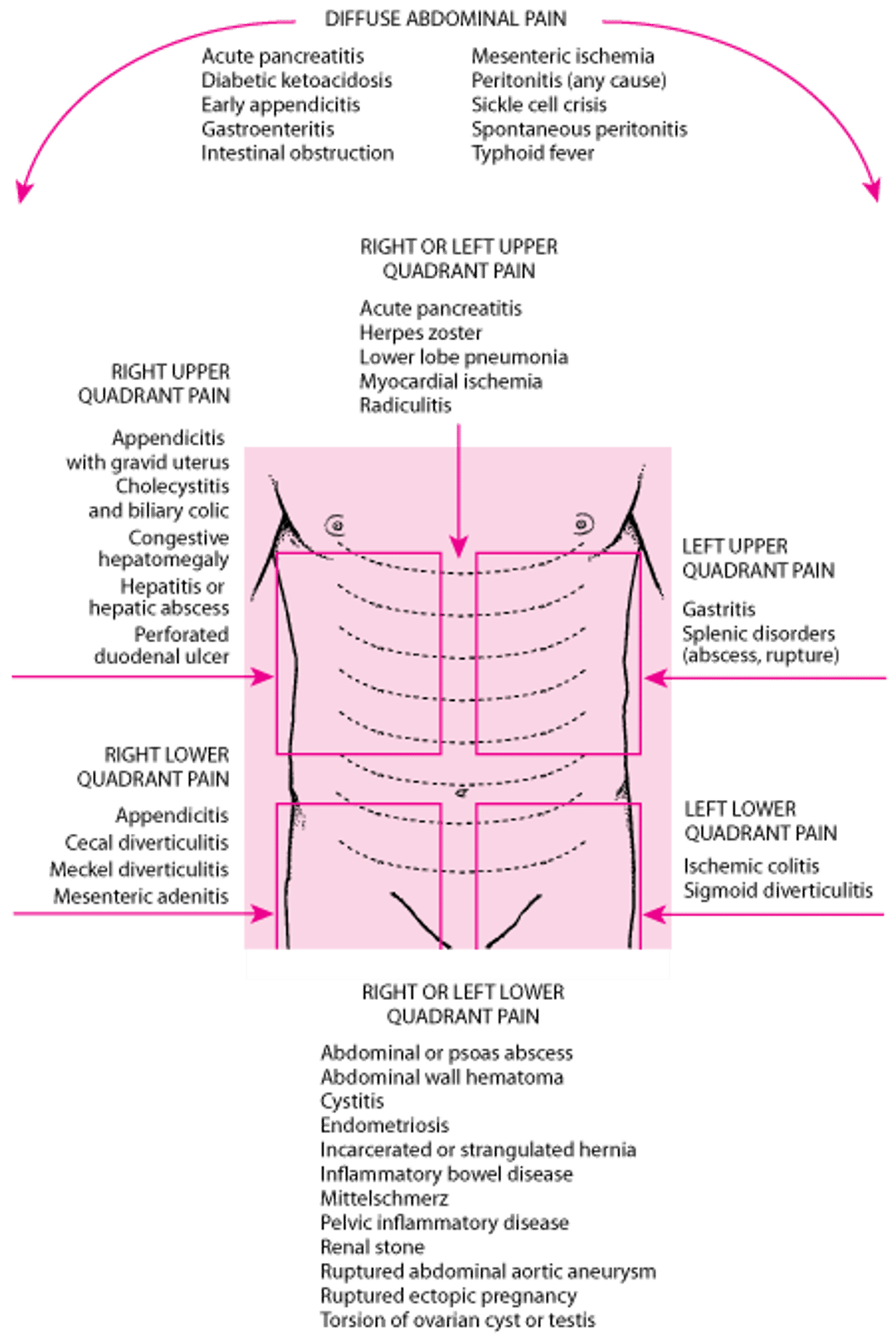 Location of Abdominal Pain and Possible Causes