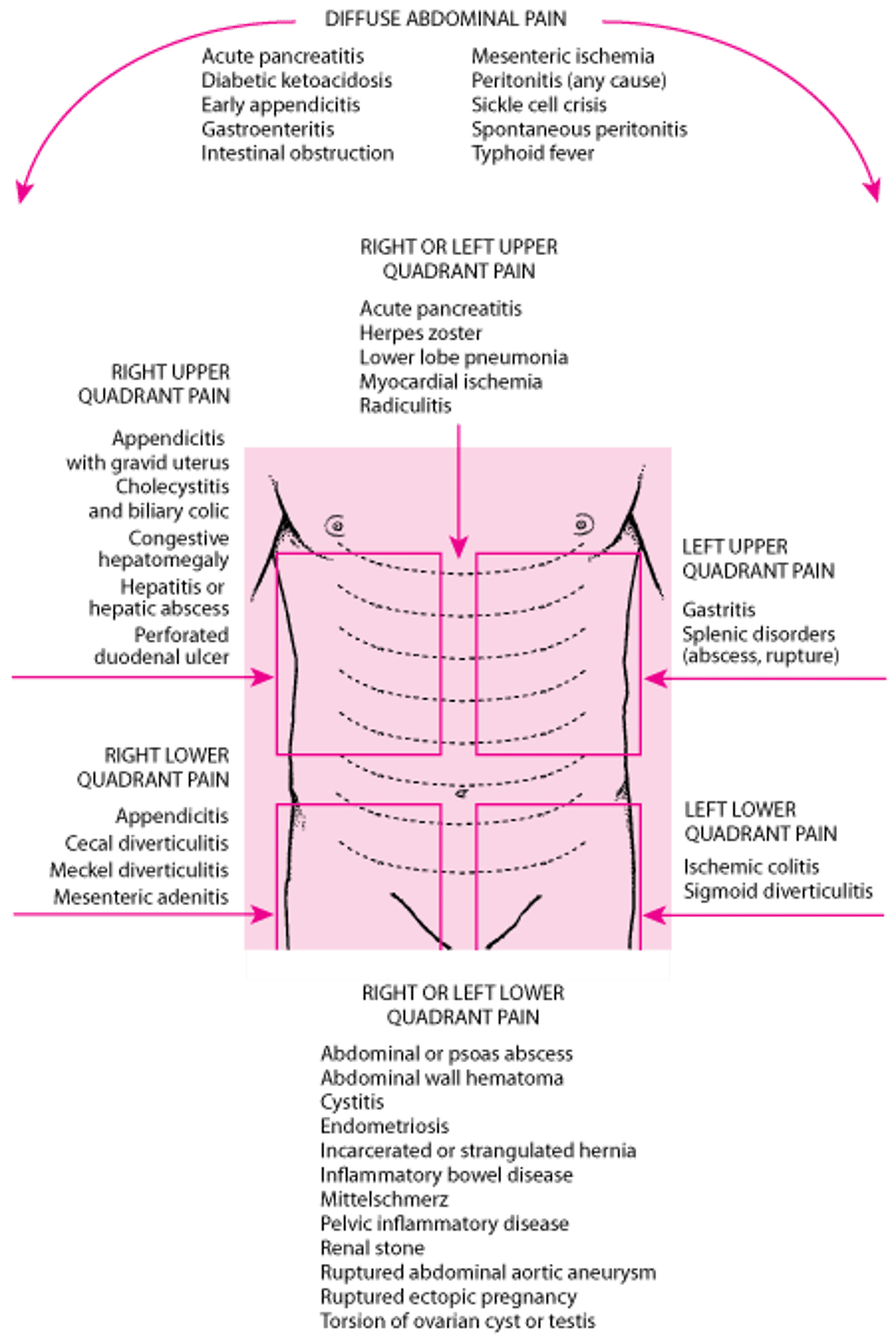 Location of abdominal pain and possible causes
