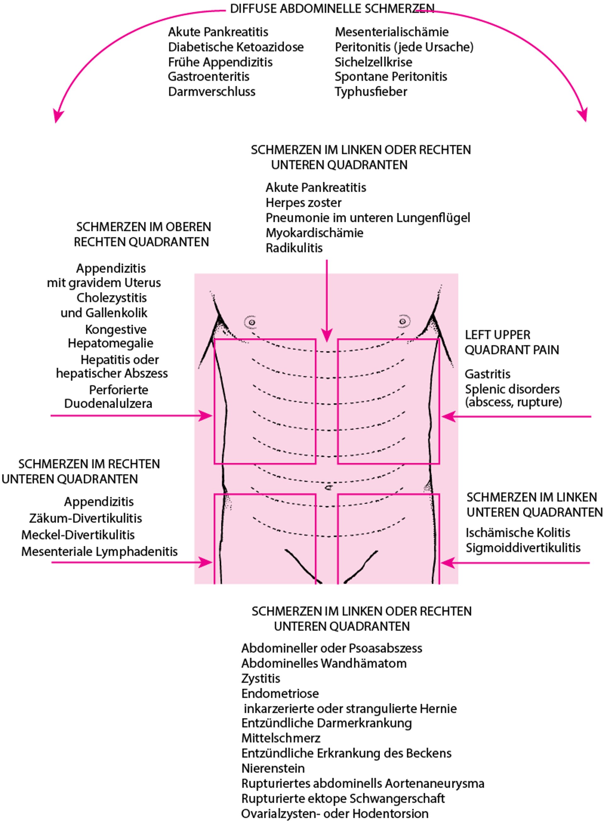 Lokalisation von Bauchschmerzen und mögliche Ursachen