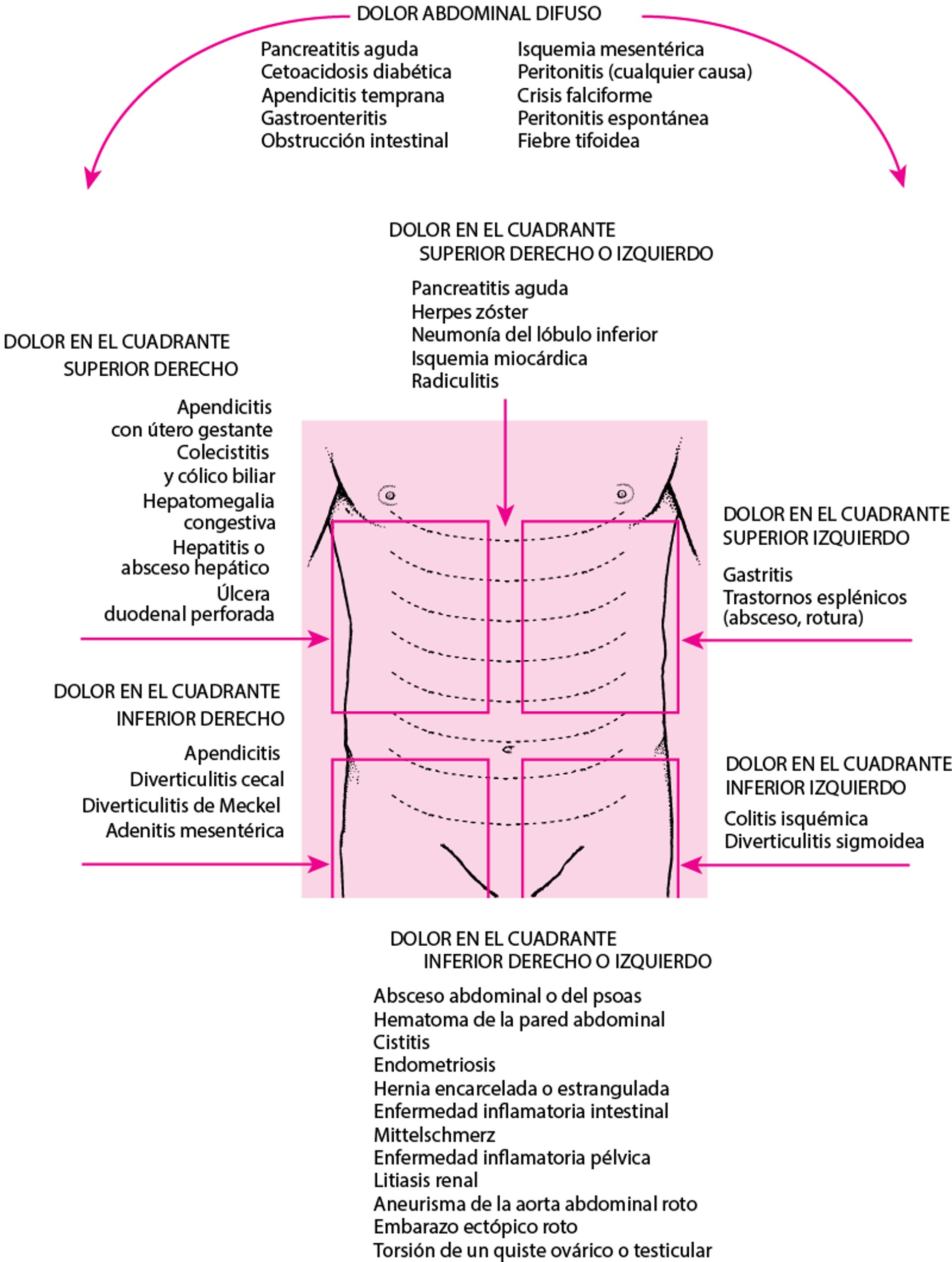 Localización del dolor abdominal y posibles causas