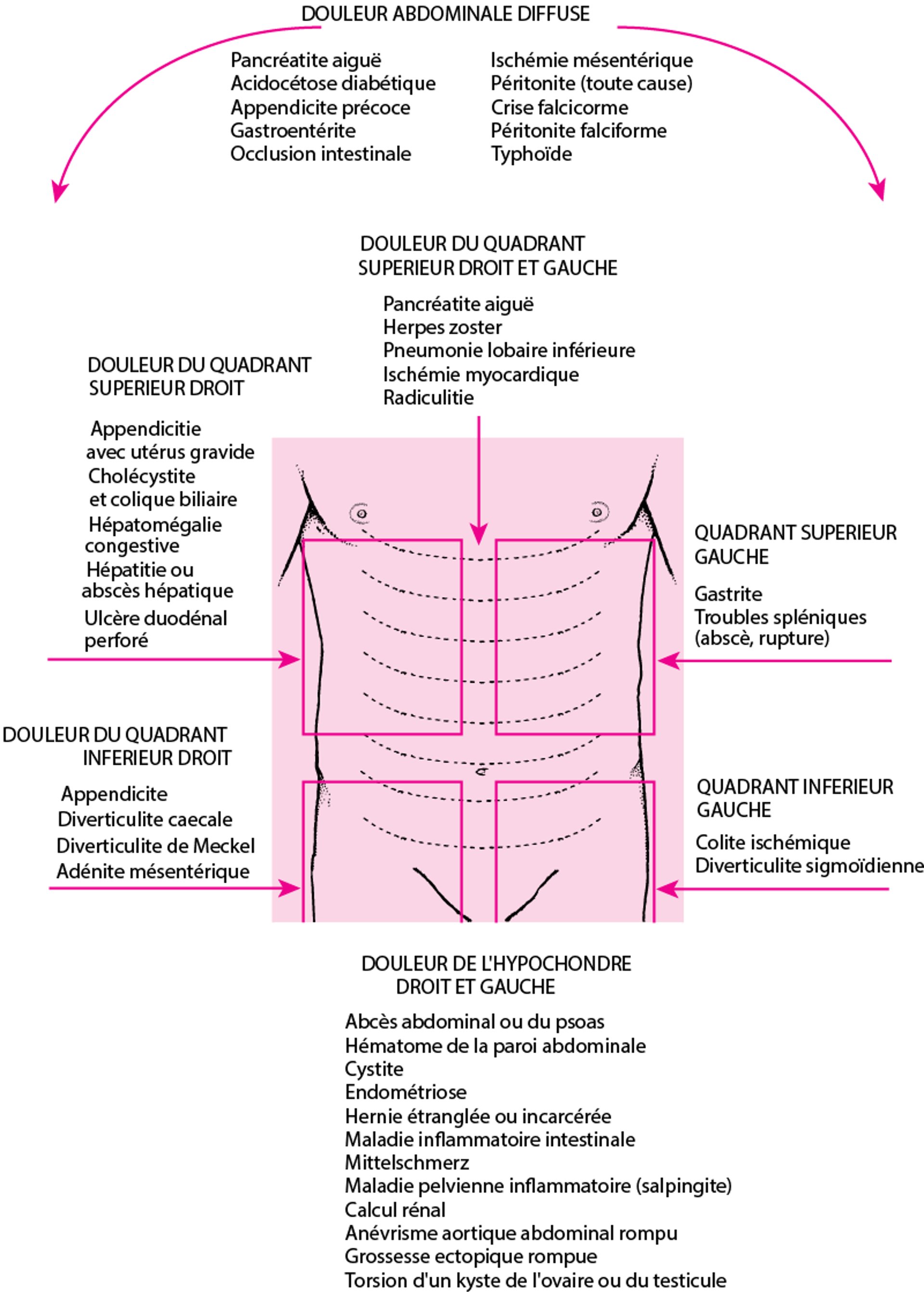 Localisation des douleurs abdominales et causes possibles